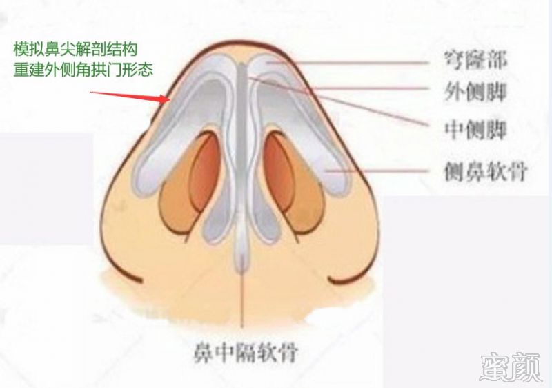 案例图片