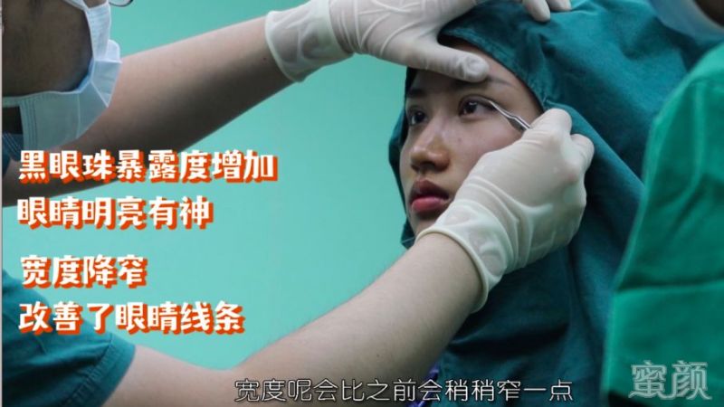 https://img.yiyiaimei.com/mnt/timg/200317/14330W309-7.jpg 案例图片