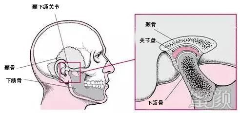 案例图片