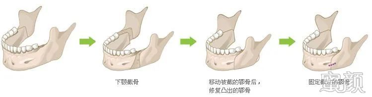 案例图片