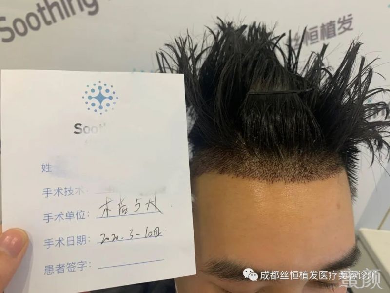 https://img.yiyiaimei.com/mnt/timg/200317/1440091412-1.jpg 案例图片
