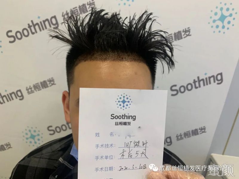 https://img.yiyiaimei.com/mnt/timg/200317/1440121C4-2.jpg 案例图片