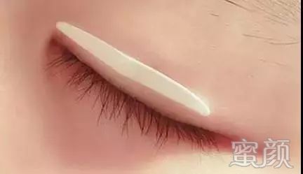 案例图片