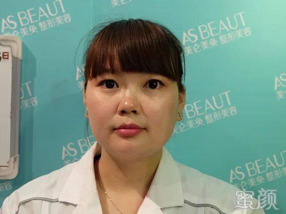 案例图片