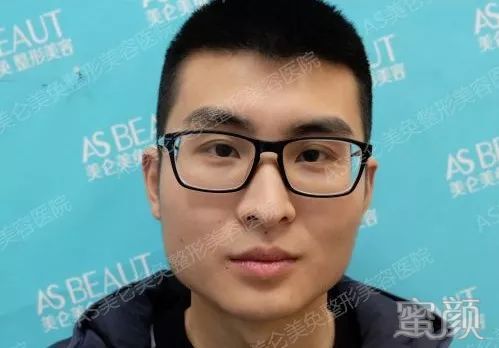 https://img.yiyiaimei.com/mnt/timg/200318/122621J43-7.jpg 案例图片