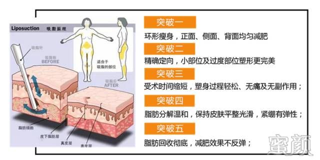 案例图片