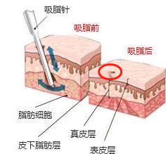 案例图片