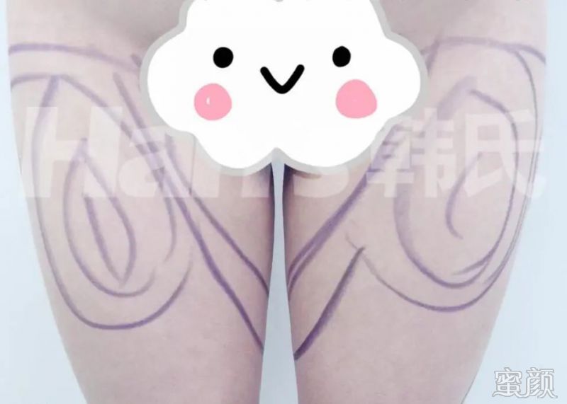 https://img.yiyiaimei.com/mnt/timg/200318/1432434L0-2.jpg 案例图片