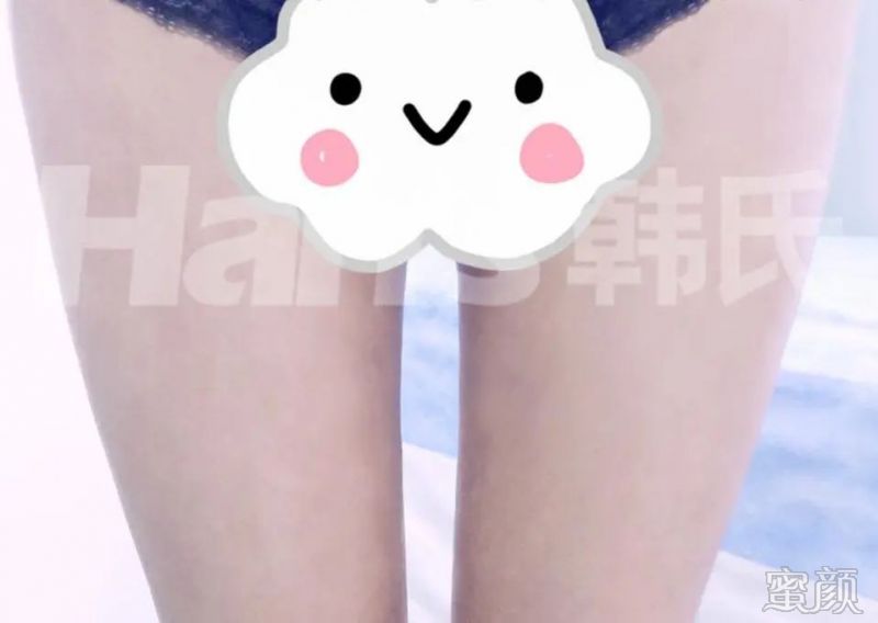 https://img.yiyiaimei.com/mnt/timg/200318/1432441622-3.jpg 案例图片