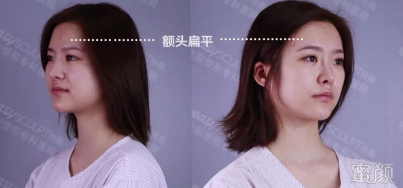 案例图片