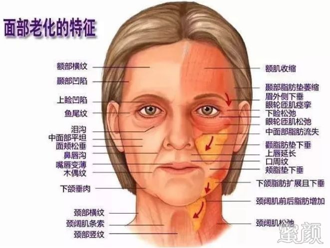 案例图片