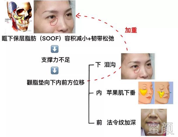 案例图片