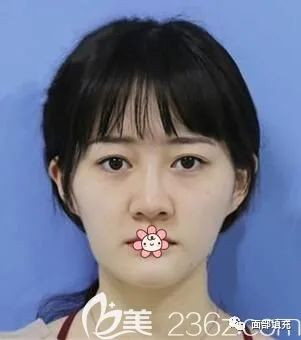 https://img.yiyiaimei.com/mnt/timg/200318/15112225P-0.jpg