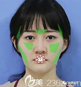 https://img.yiyiaimei.com/mnt/timg/200318/1511225161-1.jpg