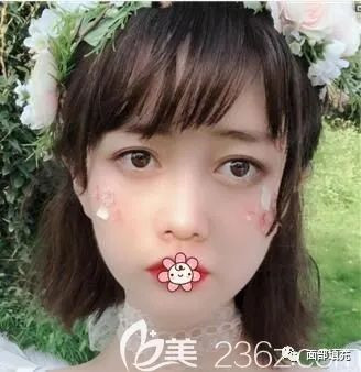 https://img.yiyiaimei.com/mnt/timg/200318/151123B45-3.jpg