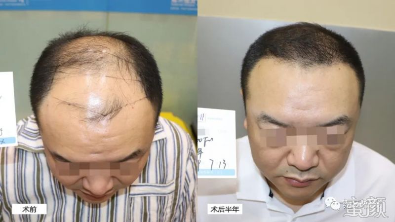 https://img.yiyiaimei.com/mnt/timg/200318/15143453M-0.jpg