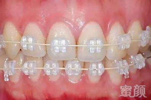 https://img.yiyiaimei.com/mnt/timg/200319/140Z041O-3.jpg