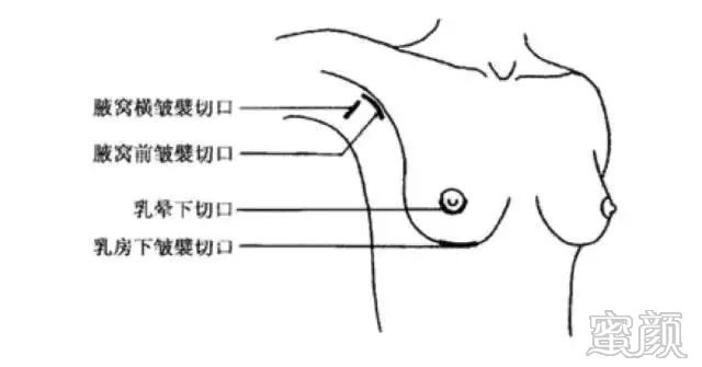 案例图片