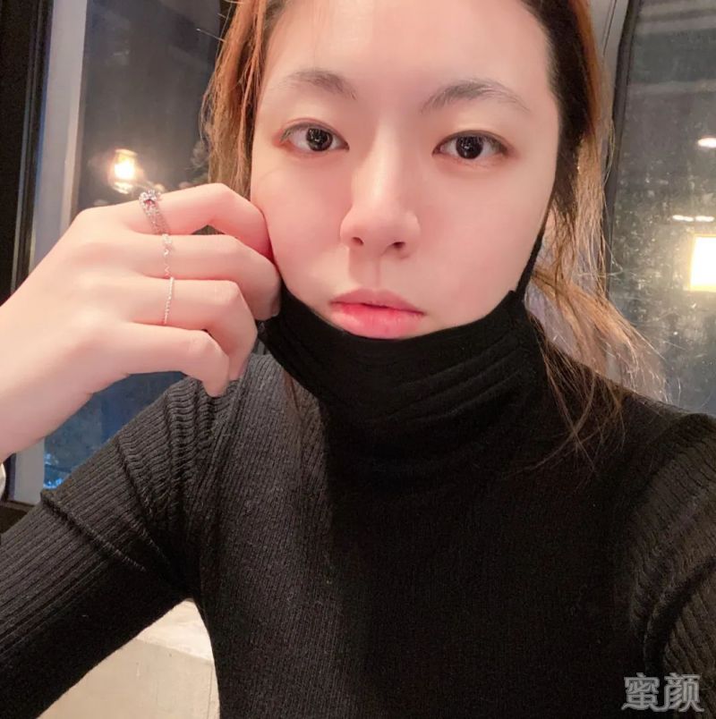 案例图片