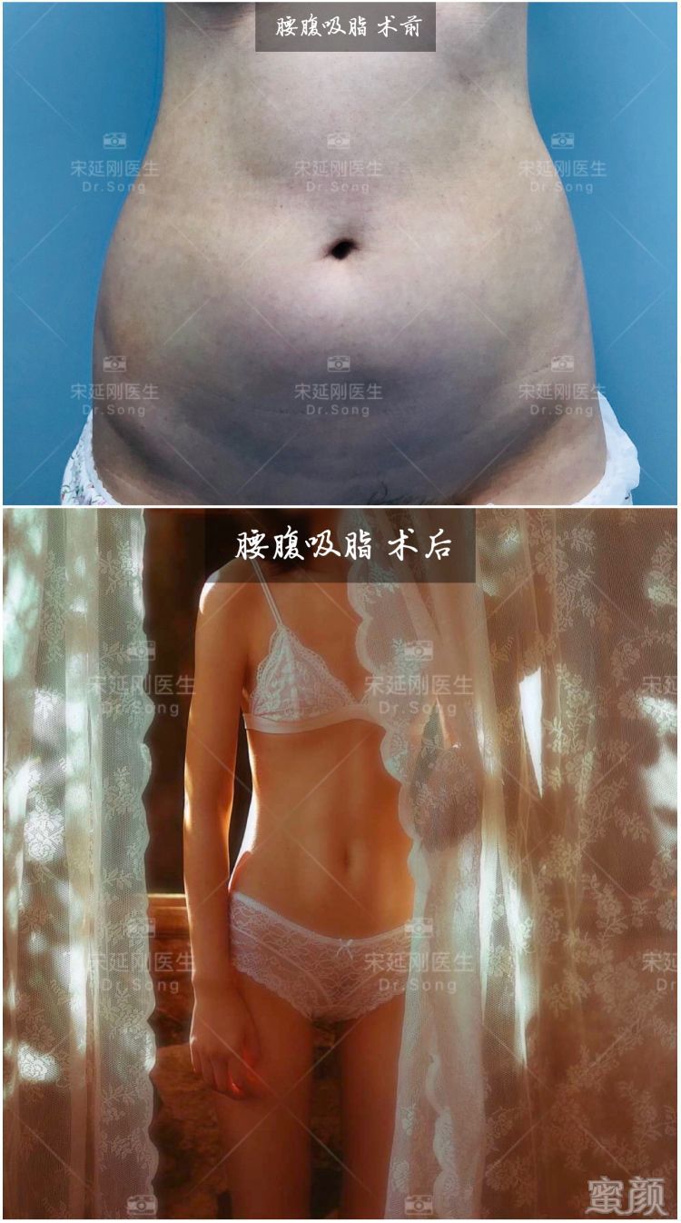 案例图片