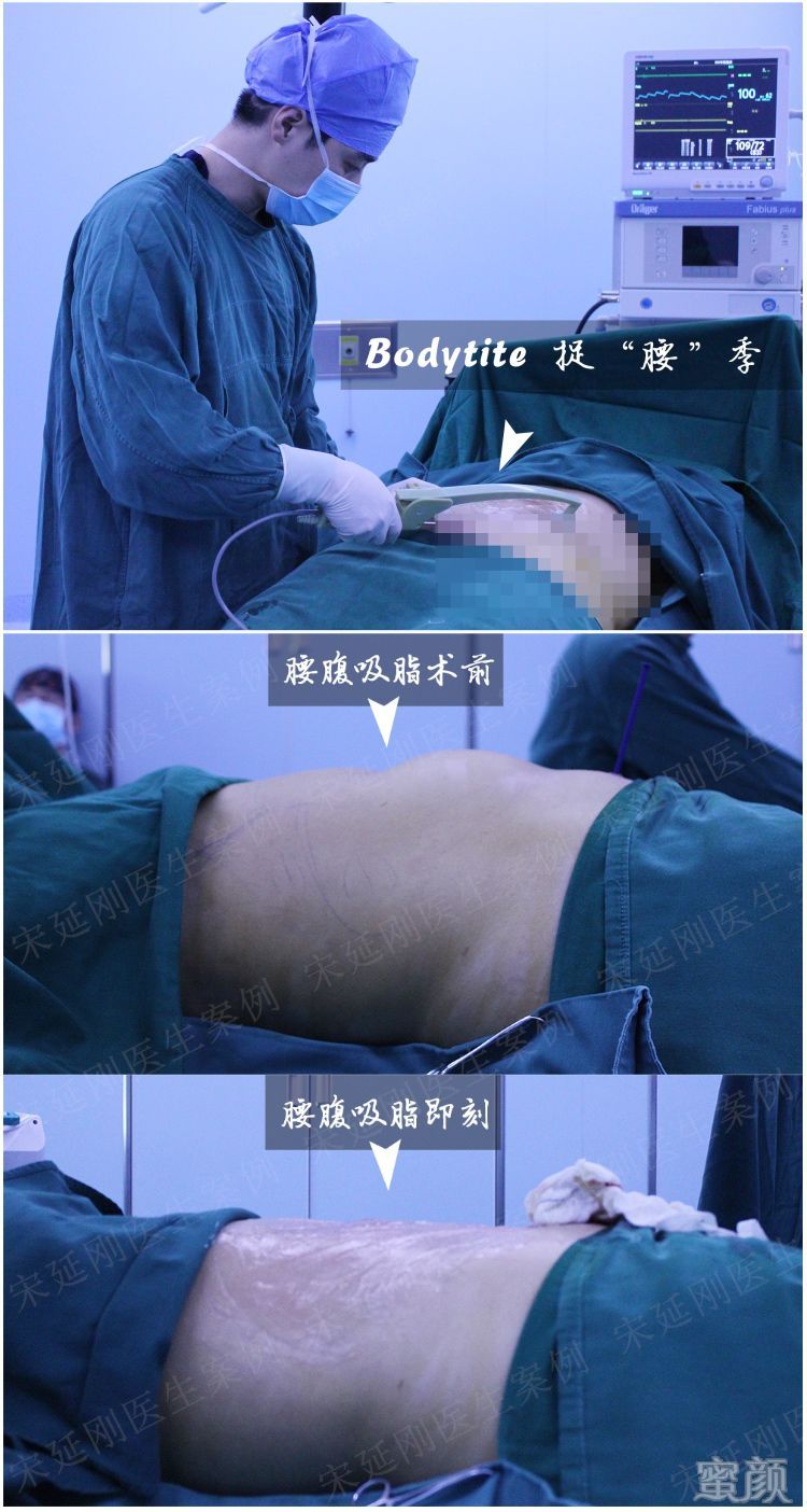 案例图片
