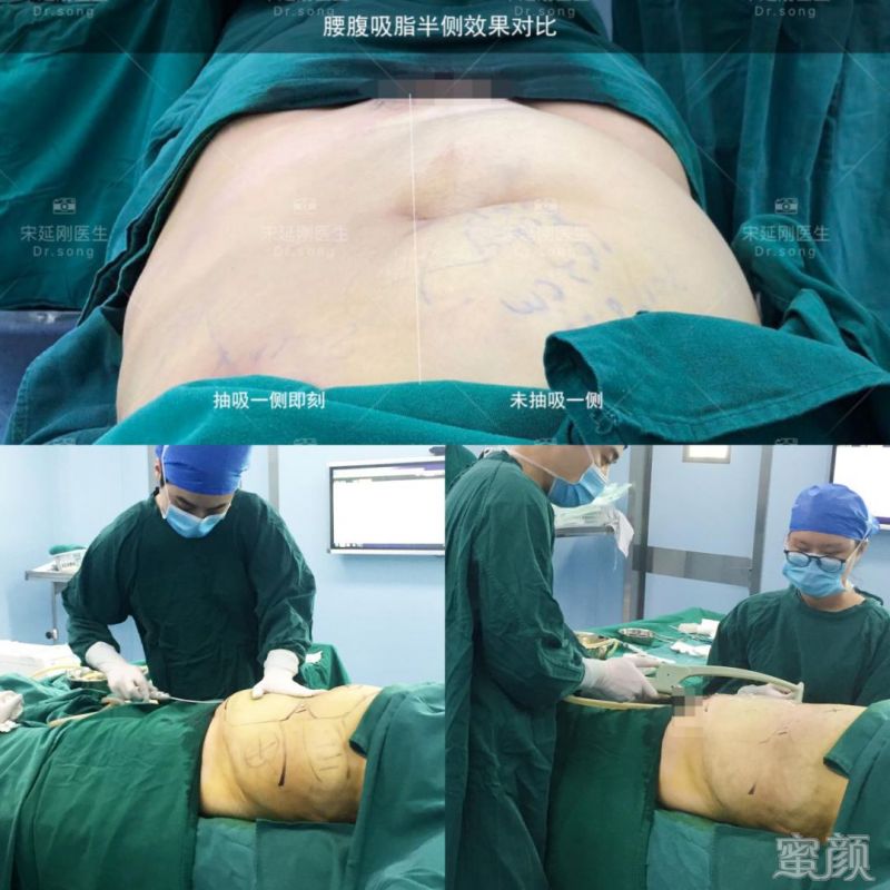 https://img.yiyiaimei.com/mnt/timg/200319/14415W644-6.jpg 案例图片