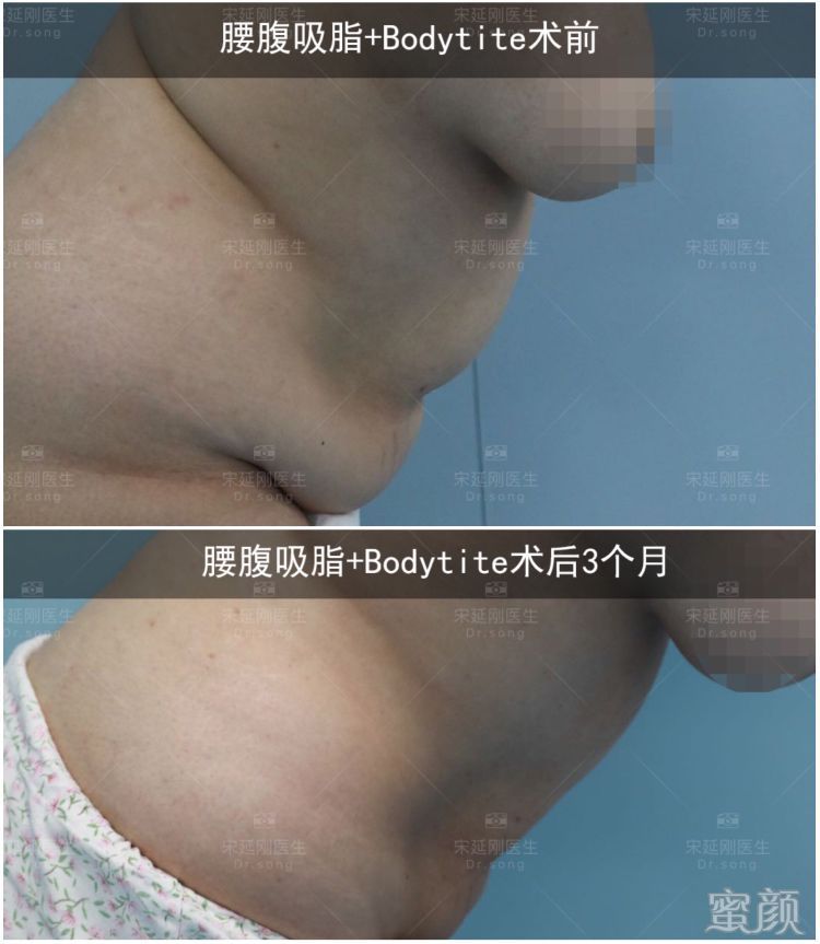 案例图片