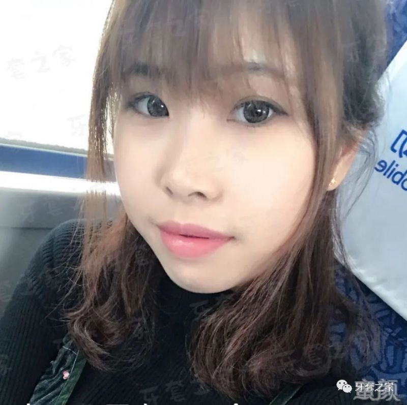 https://img.yiyiaimei.com/mnt/timg/200321/125123F39-6.jpg 案例图片