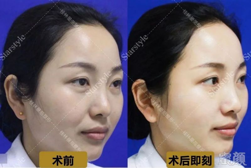 案例图片