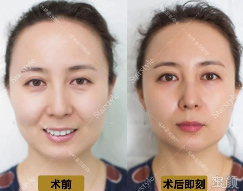 案例图片