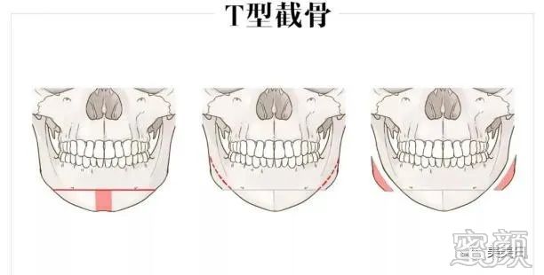 案例图片