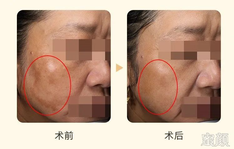 https://img.yiyiaimei.com/mnt/timg/200321/1323004323-4.jpg