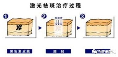 案例图片