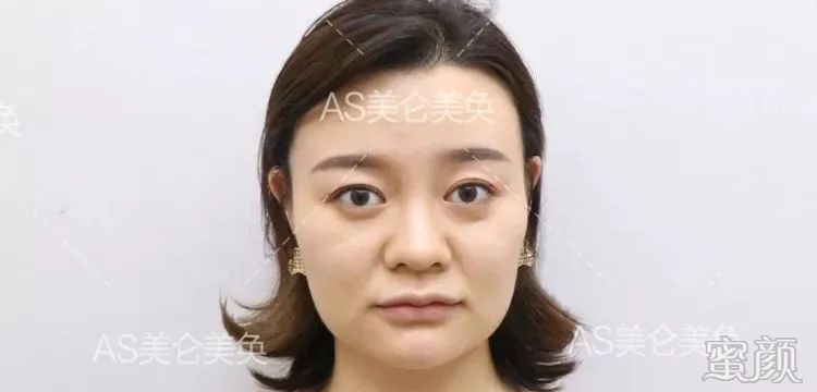 案例图片