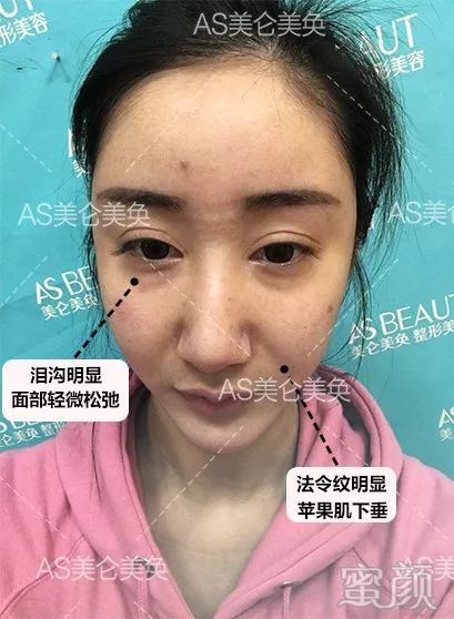 案例图片