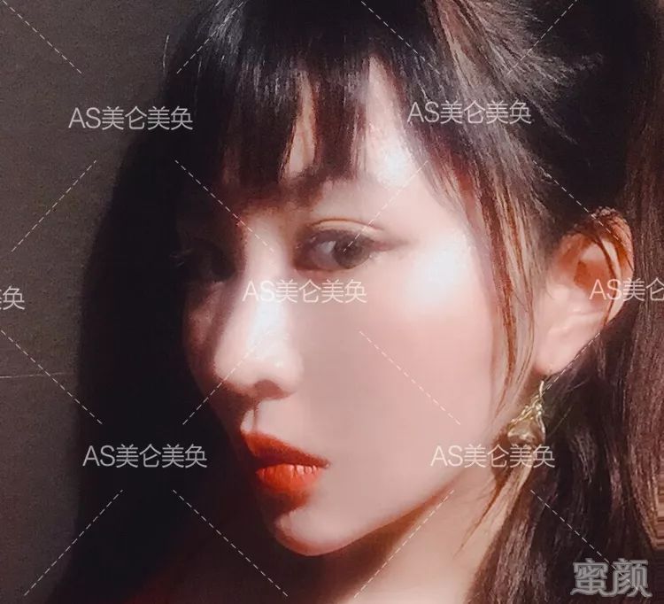 案例图片