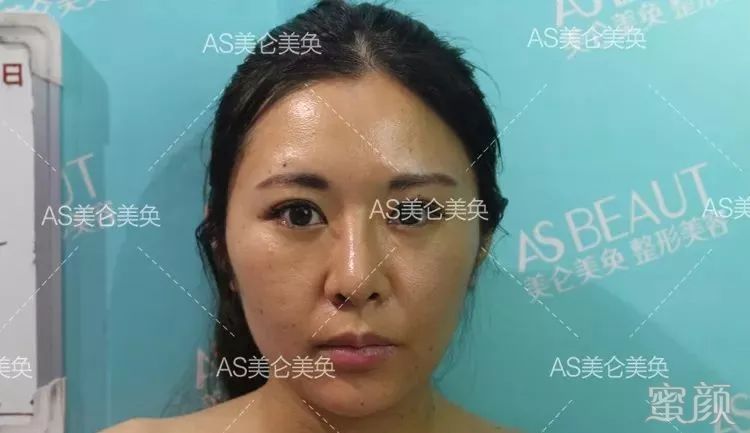 案例图片