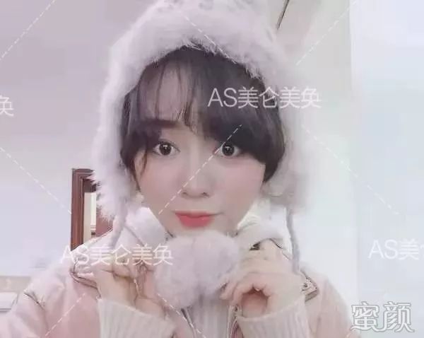 案例图片