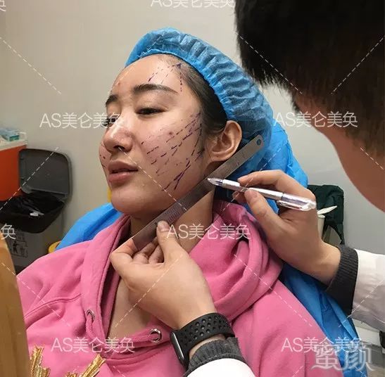 案例图片
