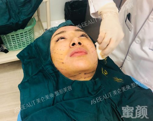 案例图片