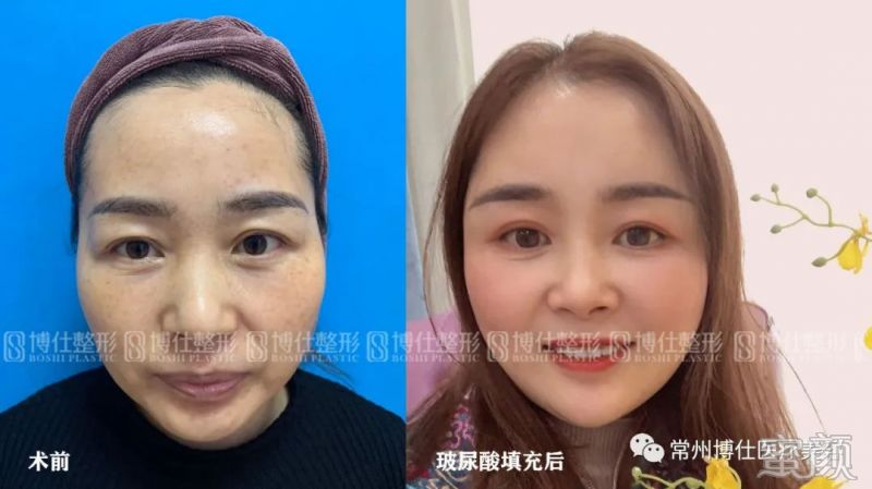 案例图片