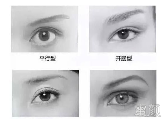 https://img.yiyiaimei.com/mnt/timg/200321/1352331531-9.jpg 案例图片