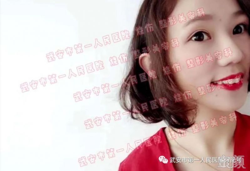 https://img.yiyiaimei.com/mnt/timg/200321/140H45958-12.jpg