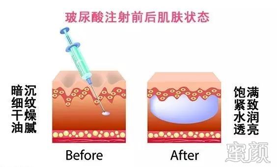 案例图片