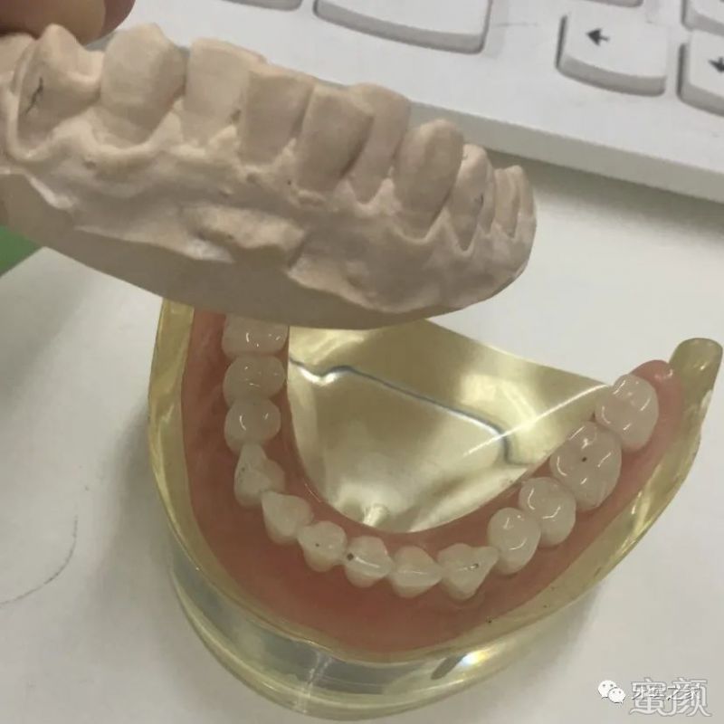 https://img.yiyiaimei.com/mnt/timg/200326/1221295232-0.jpg 案例图片