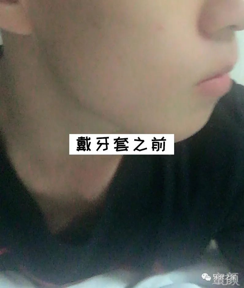 https://img.yiyiaimei.com/mnt/timg/200326/1221304H8-1.jpg 案例图片