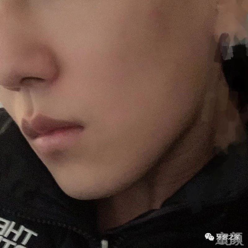 https://img.yiyiaimei.com/mnt/timg/200326/1221312J2-4.jpg 案例图片