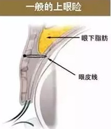 https://img.yiyiaimei.com/mnt/timg/200326/12241C954-7.jpg