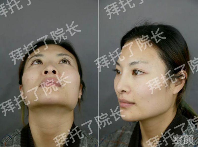 https://img.yiyiaimei.com/mnt/timg/200326/12251341H-2.jpg 案例图片