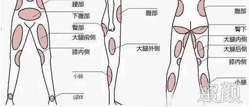 https://img.yiyiaimei.com/mnt/timg/200326/12254RH0-0.jpg 案例图片